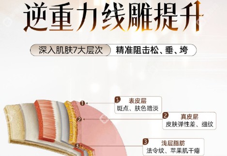 线雕