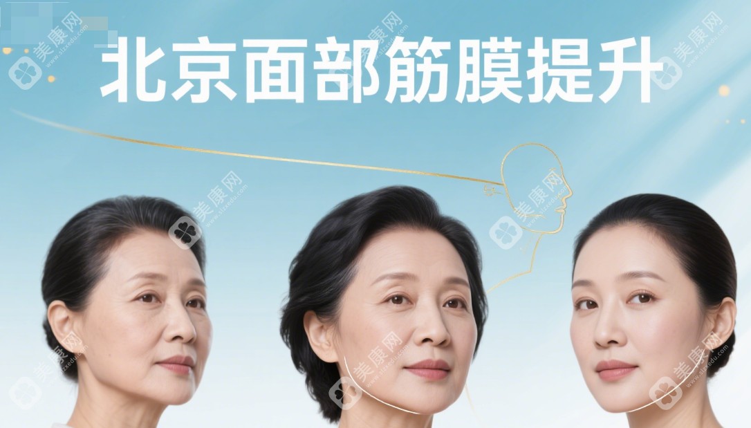北京面部筋膜提升不坑人的医美机构排行