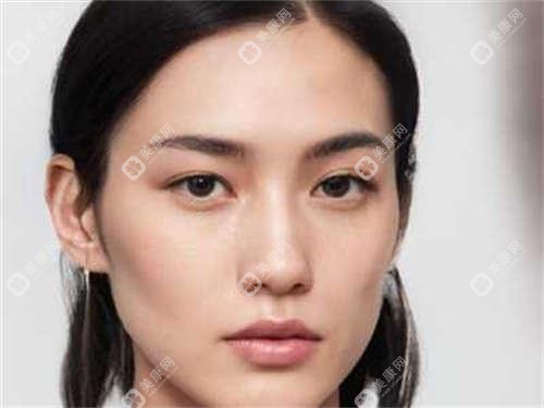北京激光除眉间纹价目表预览,想变美的小伙伴能参考