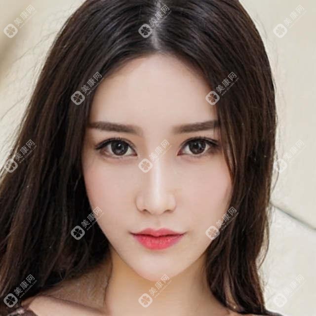 西安科大植发与锐逸植发：发际线调整+眉毛种植，真实体验分享