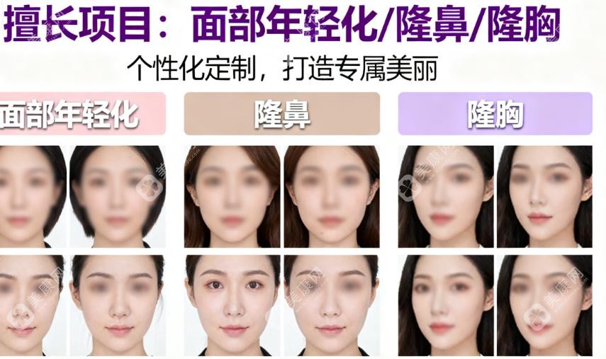 整形医生蹇洪做鼻修复怎么样