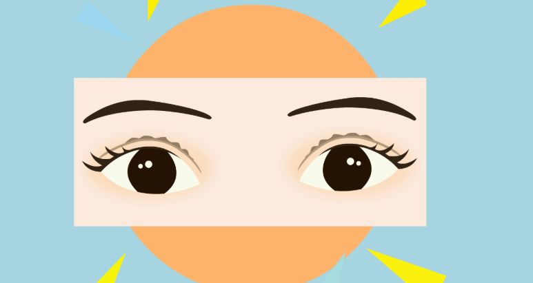 长沙唐永丰做的双眼皮修复赢麻了!眼型精细优化,睁眼超有氛围感