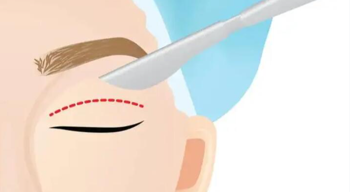 长沙唐永丰医生做的双眼皮修复怎么样?专注眼部,经验比较丰富