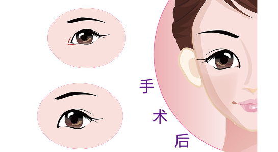 韩勋自己开诊所了位置在哪里?在海淀区善缘街1号的北京静好医美诊所,高难度眼鼻修复支持预约