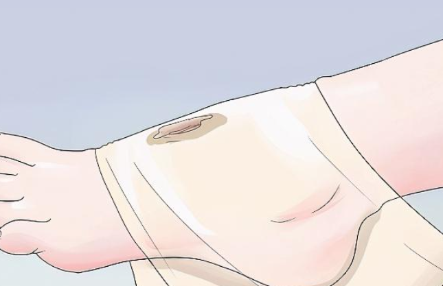 沈阳皇姑华美疤痕修复医院怎么样?资质正规可靠+技术经认证+疤痕厚度显著降低太神了!