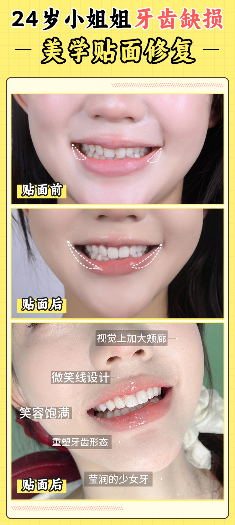 聚焦晋江青阳牙博士正规性毋庸置疑:双证医师团队坐镇,德国种植技术加持