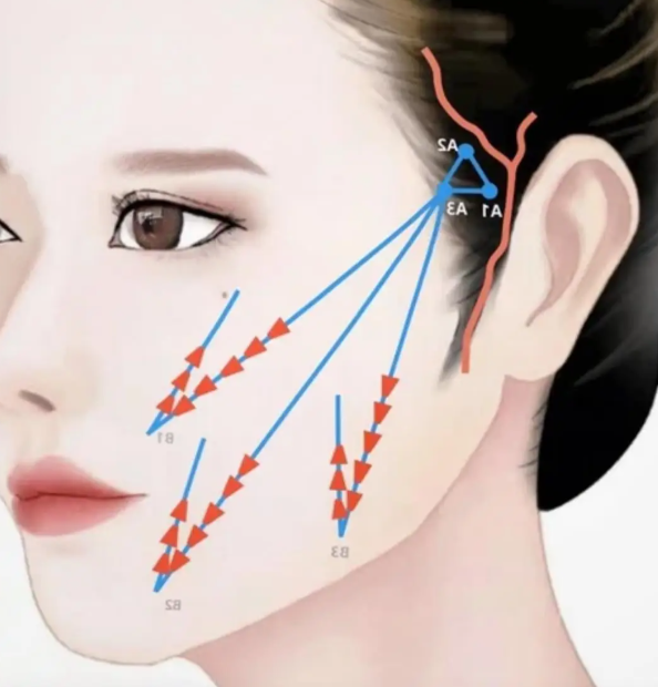 王易彬做面部提升不用愁