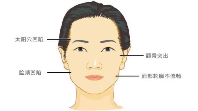 太原美媛薈脂肪填充醫(yī)生團(tuán)隊(duì)與術(shù)后管理
