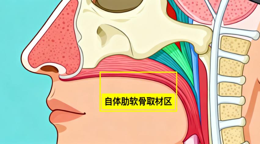 杭州鑫昕薇醫(yī)療美容醫(yī)院做鼻子好不好？2025新版10位求美者真實案例+醫(yī)生技術深度解析