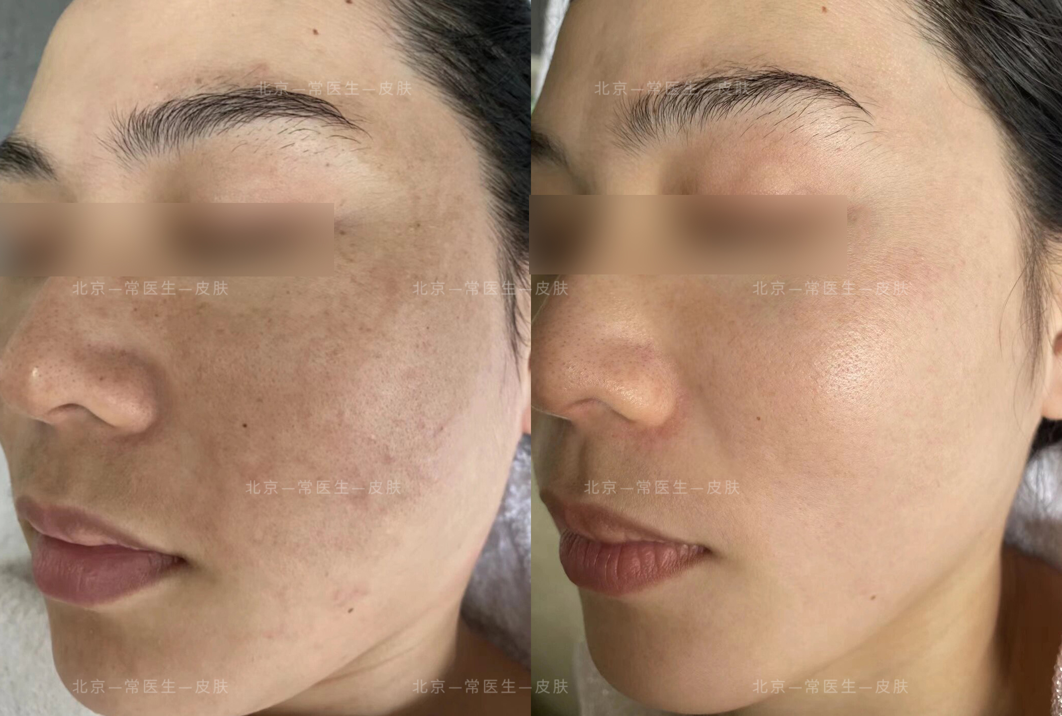   南京祛斑哪家醫(yī)院好？真實用戶反饋來了，這3家技術(shù)穩(wěn)價格合理