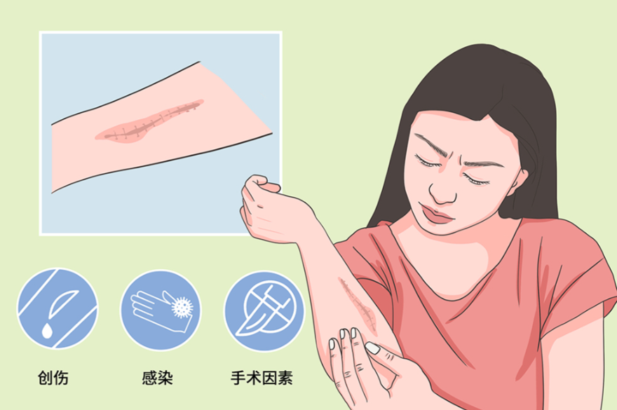 3. 泉州美萊醫(yī)療美容醫(yī)院：年輕人愛選，凹陷性疤痕/痘坑修復(fù)性價比高