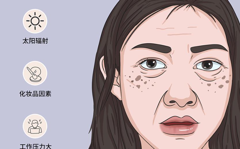 南京藝星：專注祛斑10年，老患者復(fù)購率高