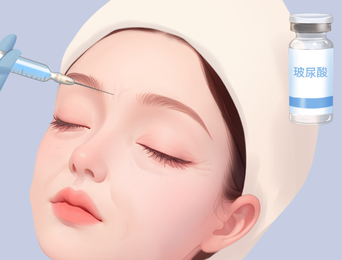 乔雅登极致注射的关键注意事项