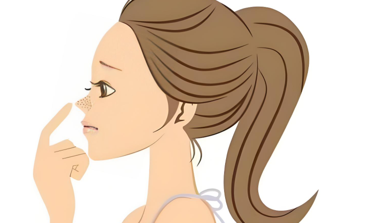 四、鼻整形术前准备与术后护理全攻略