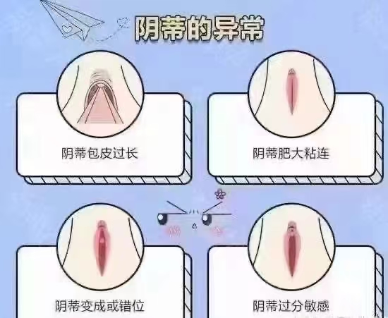 阴道紧缩术北京哪个大夫做的好？