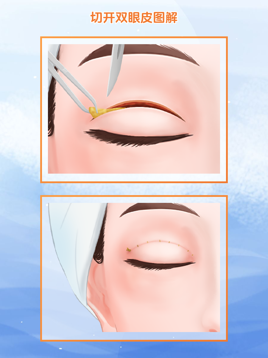 二、清木整形医院价格表（2025年当下）