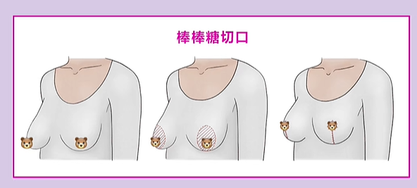 上海周立亞醫(yī)生注射胸價(jià)格表2025新版，10家醫(yī)院收費(fèi)對(duì)比+真人案例分享