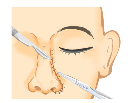 淄博向东美容整形医院价格贵吗？2025新版价目曝光，隆鼻1.2万起吸脂2.8万不贵！