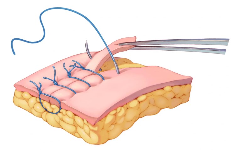 上海新星整形杨杰：求美者较关心的4个问题解答www.slzxedu.com