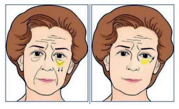   
廈門(mén)割眼袋價(jià)格大公開(kāi)！從3k到1w+的醫(yī)院收費(fèi)差異在這