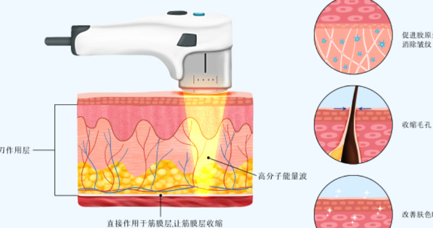 2026青島超聲炮醫(yī)院測(cè)評(píng)：這三家效果和價(jià)格超實(shí)在