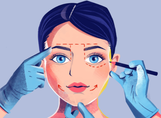 鼻基底填充需要几支玻尿酸？秦翼医生解答1-2支够用，优惠价3980元起