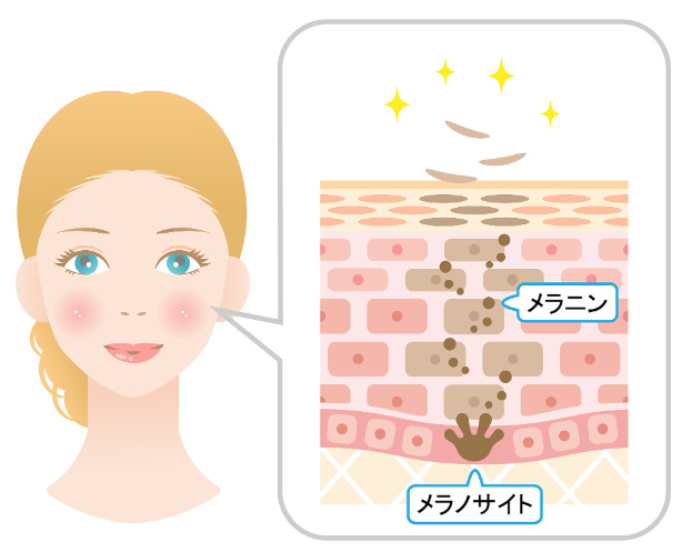 五、真实实例分享:30天祛斑疗效对比实录