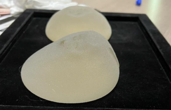 三、林沸腾医生实力：20年专注乳房整形，临床经验铸就技术标杆