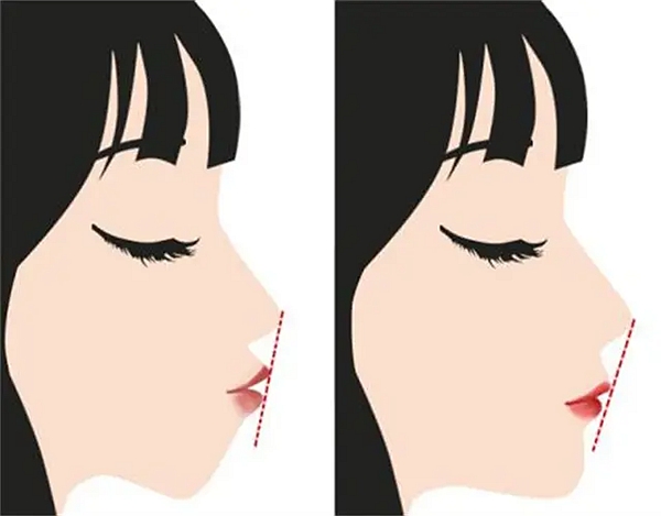 肖林医生的个人资料和擅长领域：原公立医院教授级医生，现任职重庆松山医院，擅长正颌和下颌角切除