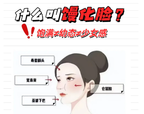 2026年北京脸部馒头化修复哪位医生好？王东高性价比+隋冰动态平衡+马梅生自然美全解析