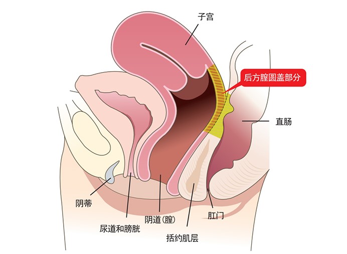 关于济南缩紧针官网预约入口(推荐美卫士),用户较常问的几个问题(FAQ)