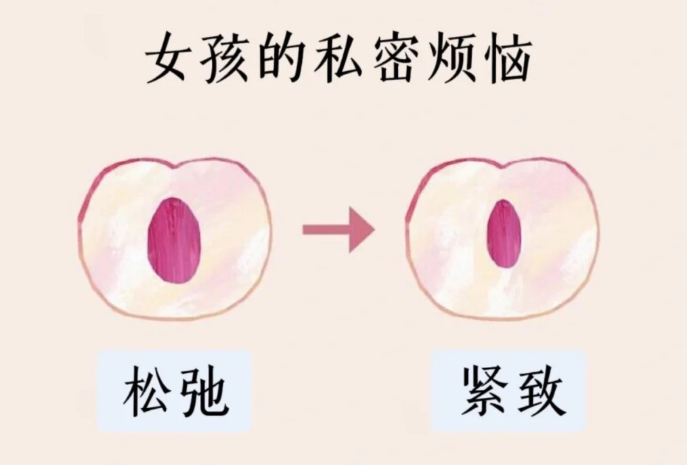 四、谁适合做济南缩紧针?看清适应症与禁忌症