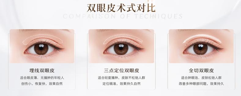 兰州谢雯双眼皮范例真实展示：技术精细，术后恢复+价格透明全解析！
