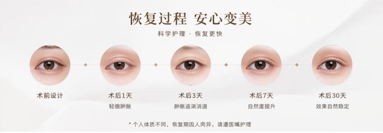 五、关于谢雯双眼皮手术的关键问题解答
