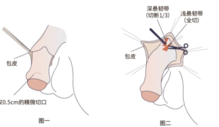 费用透明化背后的价格陷阱拆解