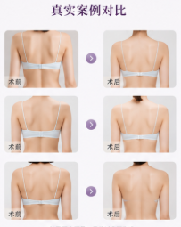 长沙欧阳鑫吸脂怎么约？美卫士小程序预约，记得提前2周锁档！