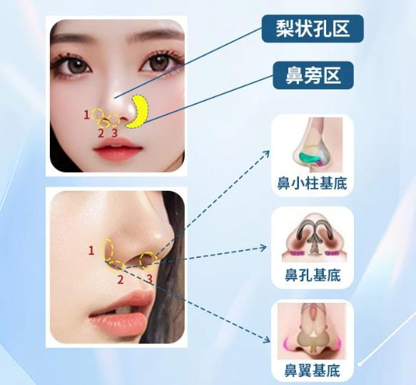 三、怎么选？优法兰0.5和1.0区别背后的选择逻辑