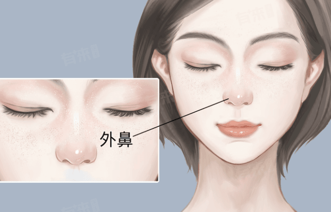 二、效果对比：优法兰0.5和1.0区别在鼻基底上如何体现？