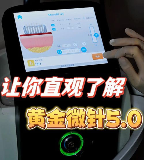 成都赫拉臻颜超声炮价格贵吗？全面部6800元起，二代皇金版更舒适