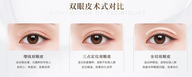 四、做完就没人管了？他的专属随访体系是亮点