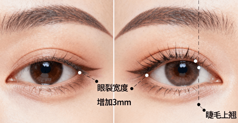成都纯曦医疗美容林靖擅长项目有哪些？主要做高难度双眼皮修复