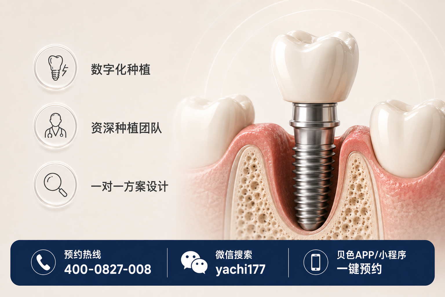 诸城莱恩口腔是正规医院吗？门诊部资质+种牙2980起+电话公众号预约，一篇讲透